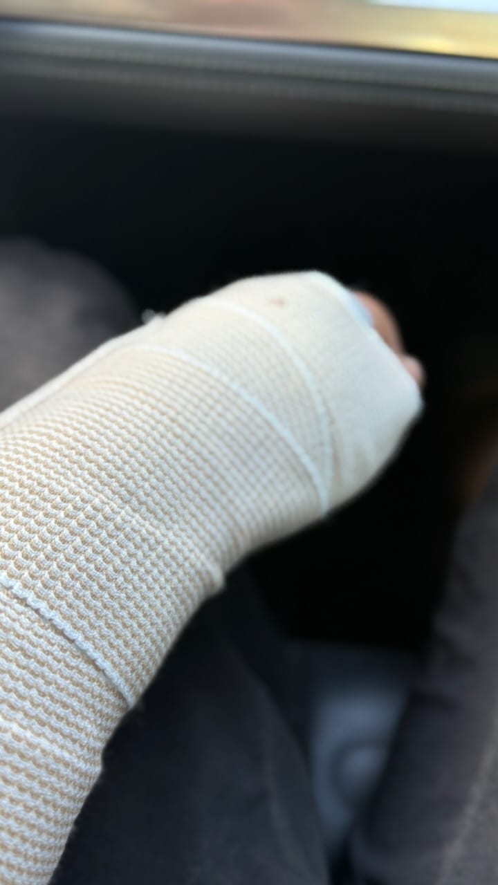 My hand and wrist wrapped in a bandage